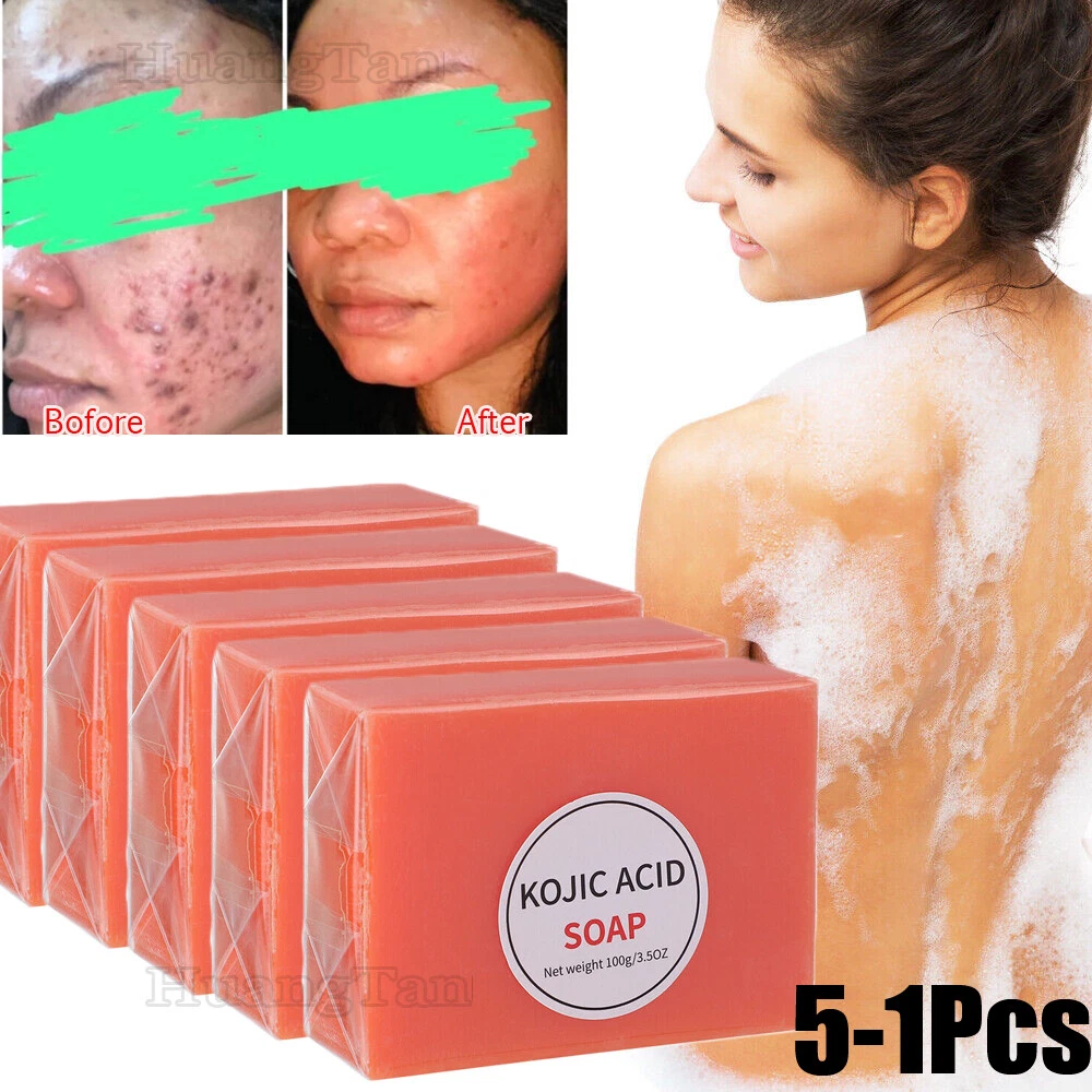 Acne 2024 off soap