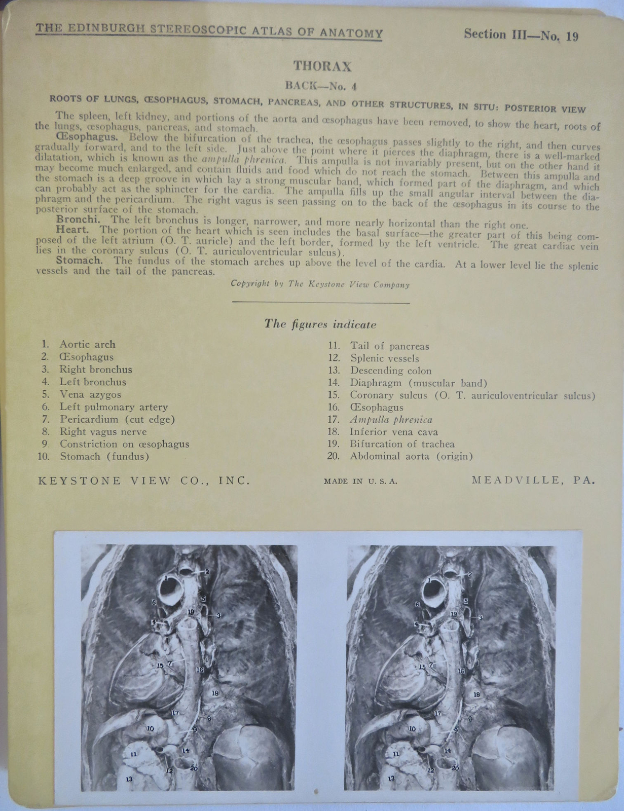 Picture 4 of 7