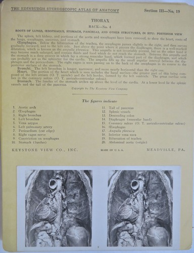 Stereoscopic Atlas of Anatomy Vol. 7 Pelvis X-Rays 1929 Set x 33 plates & case - Picture 4 of 7