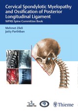 Cervical Spondylotic Myelopathy and Ossificat...