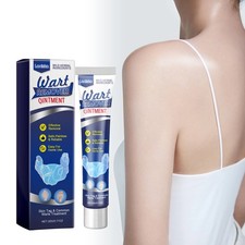 Wart Remover Ointment Gentle Nourishing Body Lotion for Smooth Skin