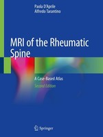 MRI Of The Rheumatic Spine Paola D'aprile