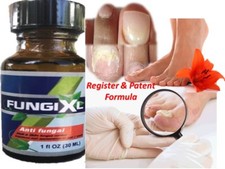 Nail Fungus Support Solution For Toe Fingers Maximum Strength toenail 100