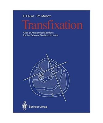 Transfixation: Atlas of Anatomical Sections for the External Fixation of Limbs: 