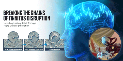 Hot DAFEILA™ SoniPulse Tinnitus Relief Soothing Aid Electric Snoring Device - Picture 13 of 13