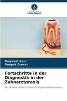 Gurpreet Kaur (U. A.) | Fortschritte In Der Diagnostik In Der Zahnarztpraxis