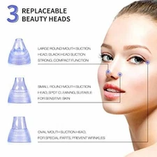 Mlikang Blackhead Acne Comedo Remover Pore Vacuum Face Nose Acne Facial Cleaner