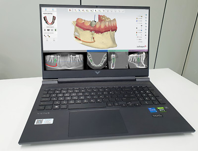 Dental CAD/CAM software Laptop full edition (3shape,inlab exocad etc ...