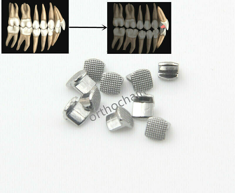 10pcs Dental Orthodontic Bite Builder Anterior Bite Turbos for deep bite correct