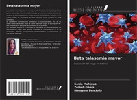 Beta Talasemia Mayor Zeineb Ghars