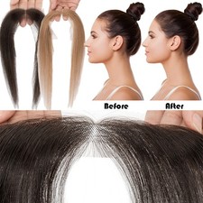 Receding Hairline Full Lace Cover Up 100 Remy Human Hair Patches Pieces Topper