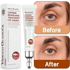 Eye Cream Instant Remove Wrinkles Eye Bag Dark Circles Anti Aging Eye Firm Serum