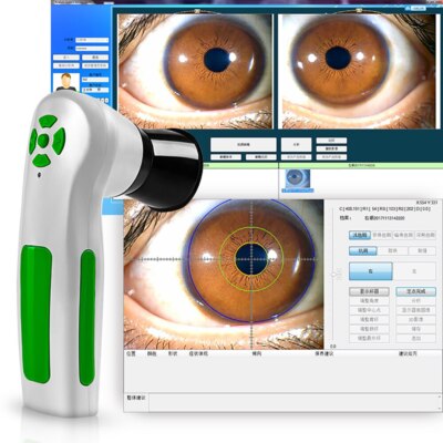 Newest Eye Camera Analyzer HD 30x Iris Lens CCD USB Iriscope 9811U Diagnostic US