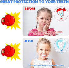 6 Pack Kids Mouth Guard, Toddler Sport Mouth Guard Kids with 6 Portable Cases...