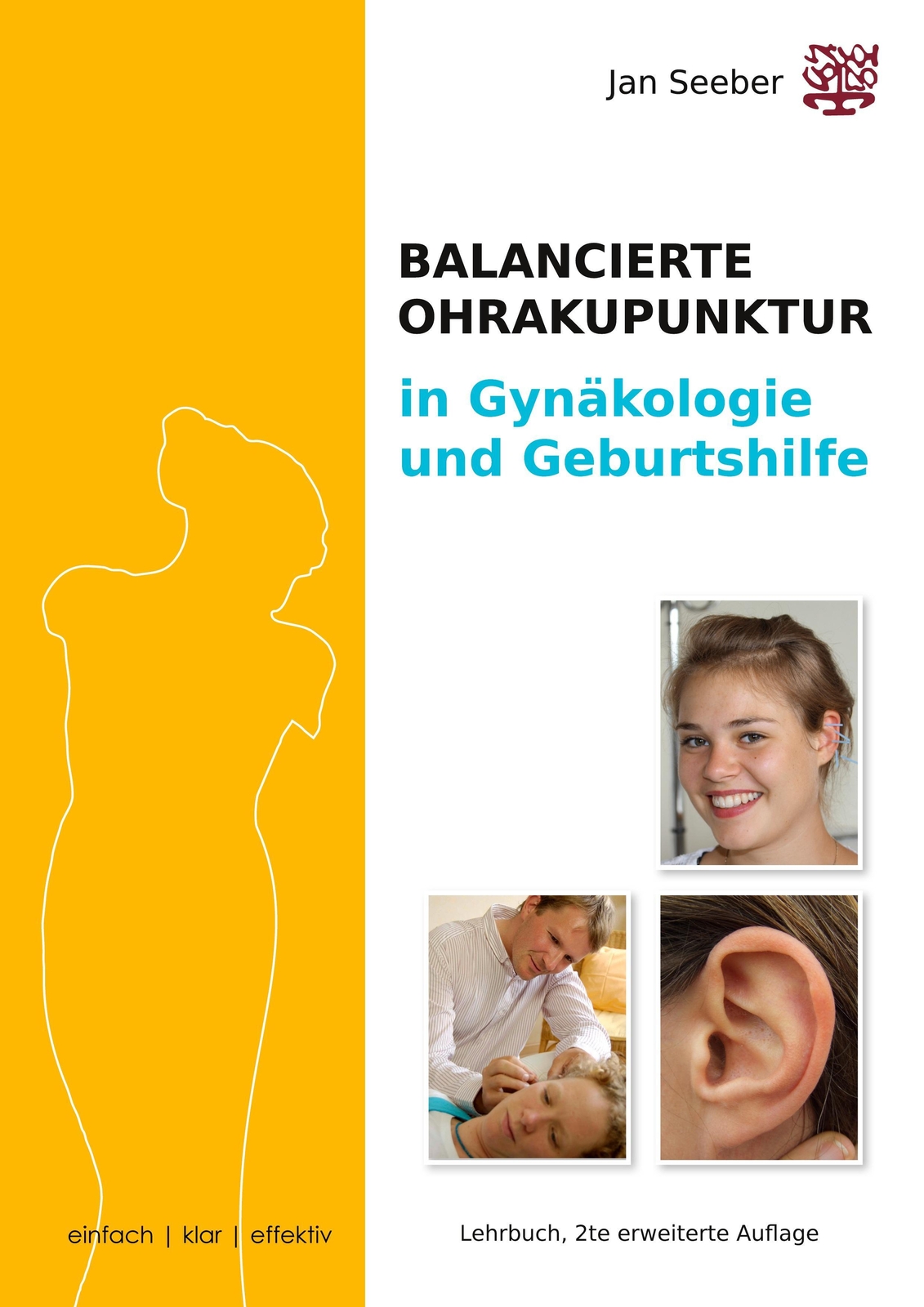 Thumbnail - Ohrakupunktur In Gynäkologie & Geburtshilfe Jan Seeber Taschenbuch