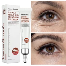 Eye Cream Instant Remove Eye Bags Dark Circles Anti Wrinkle Depuffing Firming