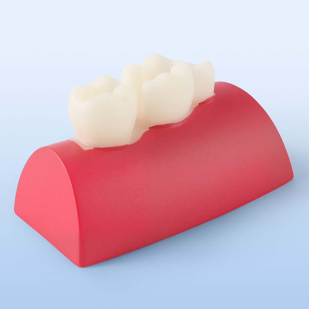 Portable Dental Mobile Digital X Ray Machine High Frequency+Non Shield/Sensor