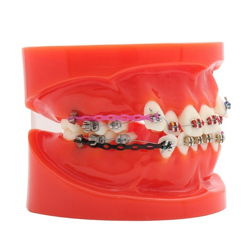 Multiple Types Dental Teeth Model Ortho Implant Practice Teaching Demo Model - Picture 22 of 276