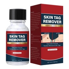 Skin Tag Remover 15ml Skin Warts Moles Removal Solution