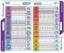 EKG Rhythm Interpretation - Compact & Portable Reference Card – Rapid Interpr...