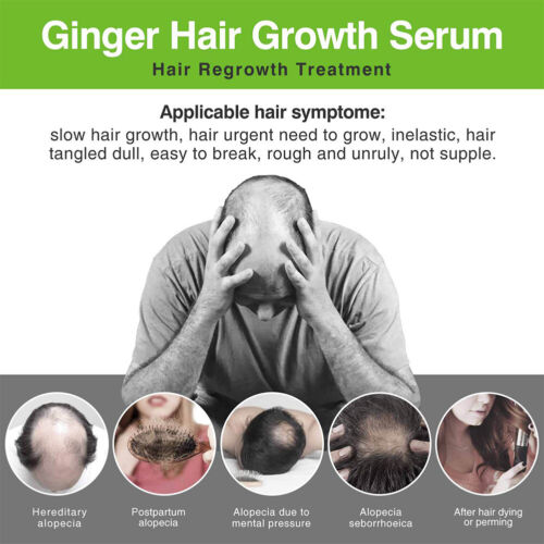 10 ml Serum para Rápido Recrecimiento, Spray Natural Anti Caída de Caída para Sc - Imagen 12 de 12