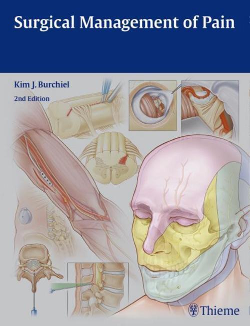 Thumbnail - Surgical Management Of Pain Kim J Burchiel