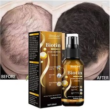 Biotin Hair Growth Spray Anti Hair Loss Fast Regrowth Scalp Treatment Serum