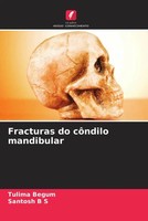 Tulima Begum (U. A.) | Fracturas Do CôNdilo Mandibular | Taschenbuch (2022)