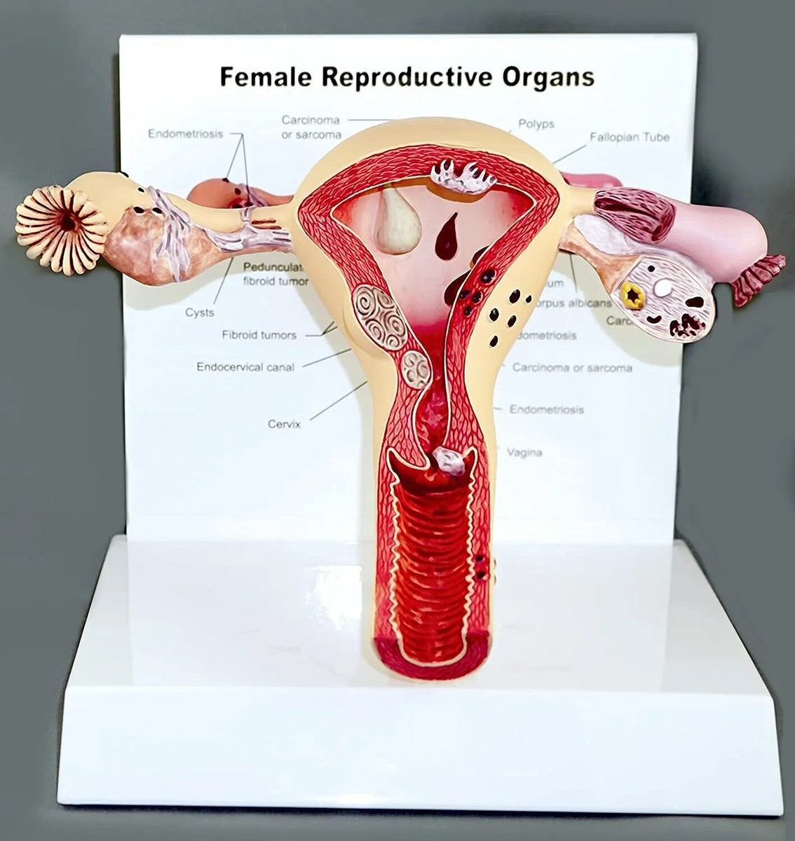 Ovary Models At Rs 22500 | Anatomical Models, Human Anatomy Models, image size:1134x1200