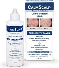 Scalp Topical Solution for Symptoms of Mild to Moderate Psoriasis, Dry Red Scalp