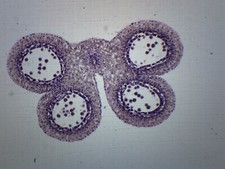 10PK Lilium Anther, Meiotic Division, Microscope Slides, 75x25mm - Eisco Labs