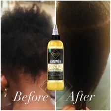 ORGANIC Hair Growth Oil- Itchy scalp, ALOPECIA, OVER 20 ORGANIC OILS-4oz