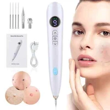 Mini Beauty mole Removal Sweep Magic Spot Pen White Anti-Aging Laser Plasma Pen