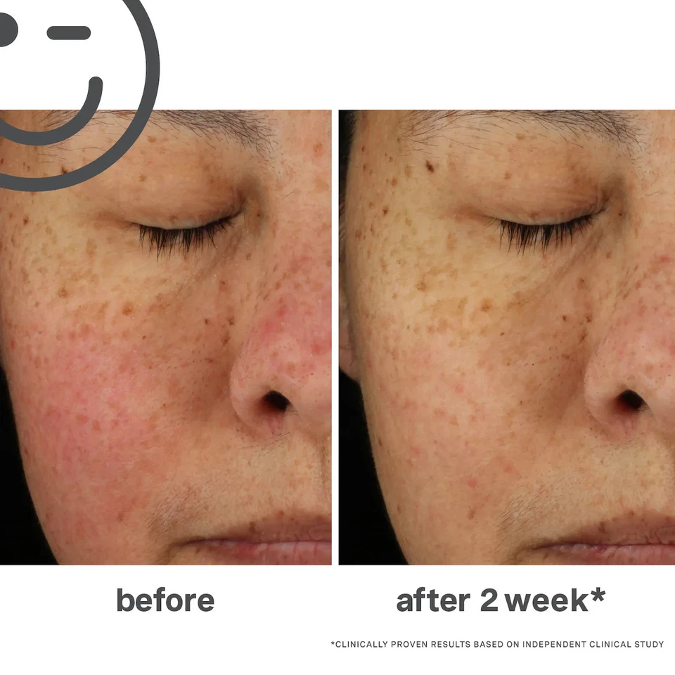 NEW Kate Somerville Skin Health Expert Total Repair Cream 1 fl. /100%AUTHENTIC - Image 2 of 4