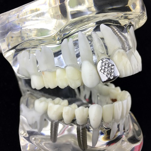 Diamante Design One Tooth Grillz Cap Single Silver Tone Simulated CZ Iced Slug - Picture 8 of 8