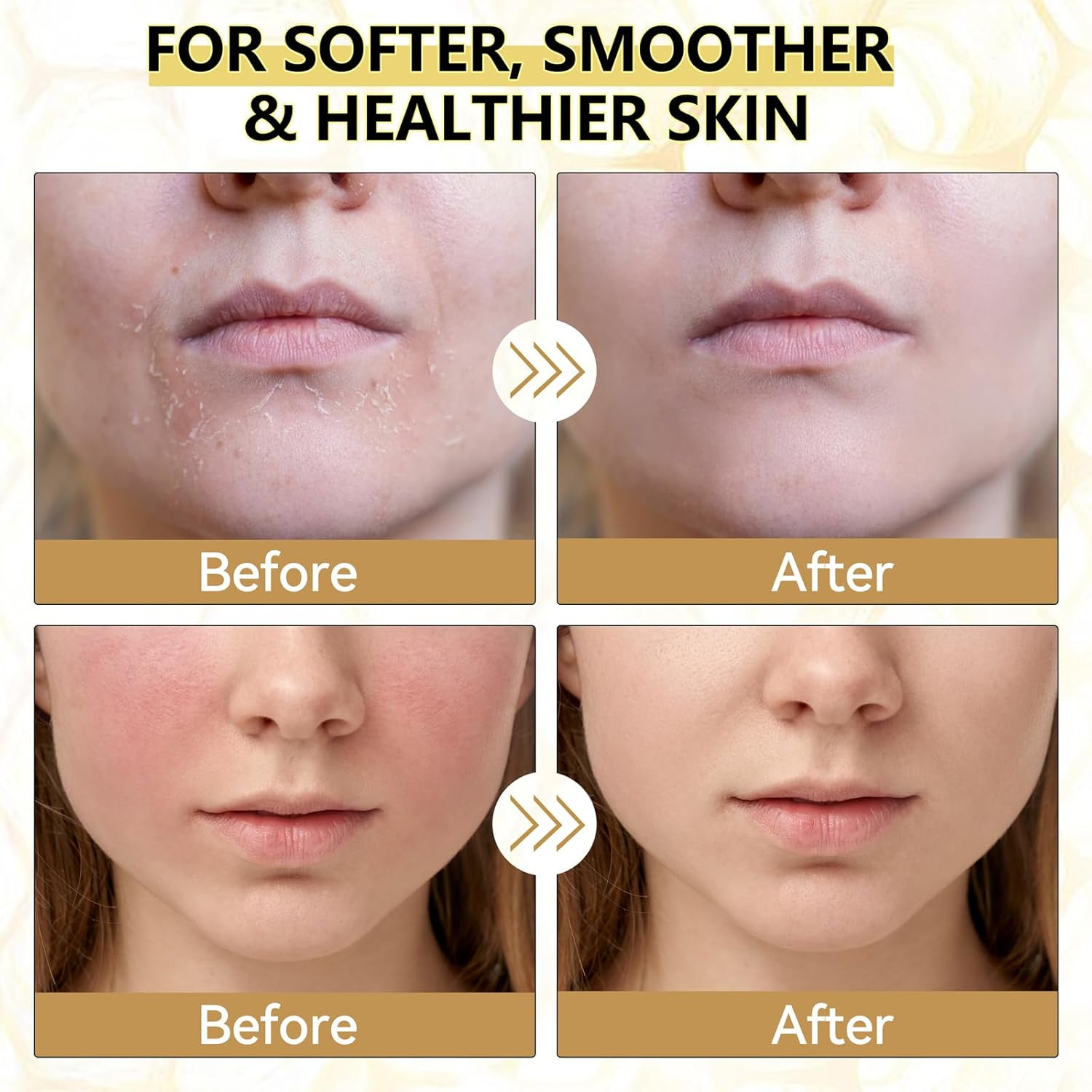 Beef Tallow for Skin, Organic Whipped Tallow and Honey Balm, Grass Fed Beef Tall