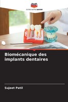 Sujeet Patil | BioméCanique Des Implants Dentaires | Taschenbuch | FranzöSisch