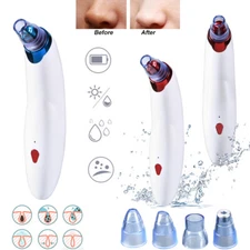 Facial Cleansing Device for Blackheads - Ideal for Home Use, Gentle & Effective
