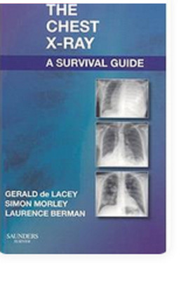 Chest X-Ray A Survival Guide A Survival Guide Paperback u835