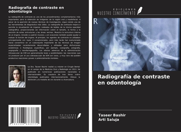 RadiografíA De Contraste En OdontologíA Taseer Bashir (U. A.) Taschenbuch 2025-image