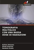 Kaline Antunes (U. A.) | Tomografia Multislice Con Una Bassa Dose Di Radiazioni