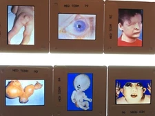 300 35mm Slides Medical Terminology pathology disease teaching graphic images