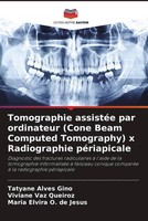 Tatyane Alves Gino (U. A.) | Tomographie AssistéE Par Ordinateur (Cone Beam...