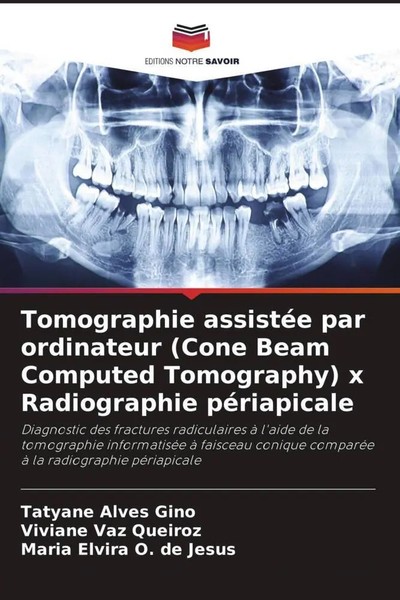 Tatyane Alves Gino (U. A.) | Tomographie AssistéE Par Ordinateur (Cone Beam...-image