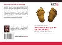 Ana Noelia HernáNdez GonzáLez | Distrofia Muscular DE Duchenne: | Taschenbuch