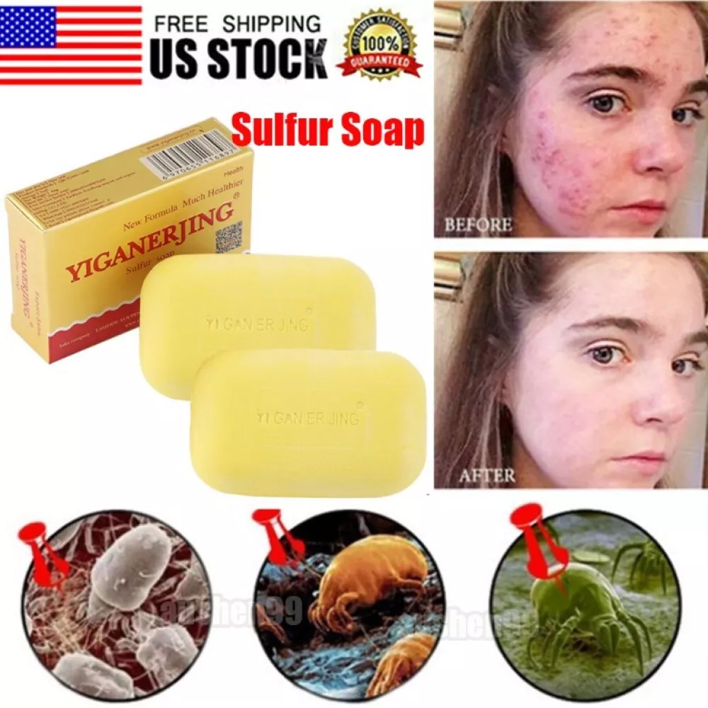 Sulfur Soap Mite Remover Soap Anti Fungal Scabies Acne Treatment Bath Soap 80g