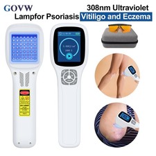Handheld 308nm UV Light Therapy for Arm Foot Skin Diseases Treatment 49 Diodes