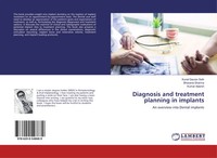 Kunal Gaurav Seth (U. A.) | Diagnosis And Treatment Planning In Implants | Buch