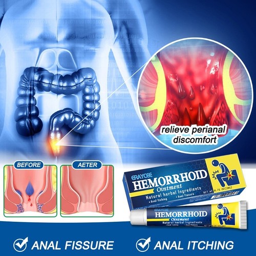 Crema a base de hierbas para eliminar las hemorroides para aliviar el dolor reducir la picazón 3X * 20 g - Imagen 8 de 14