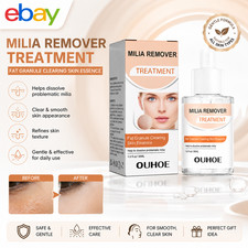 Milia Remover Treatment Milia Spot Removal Serum For Face Helps to Reduce UK